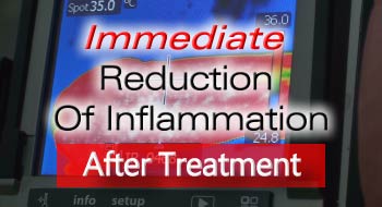 VET Sonotron Mark2 Reduces Inflammation Of SDF Tendon Of Racehorse Immediately After Treatment